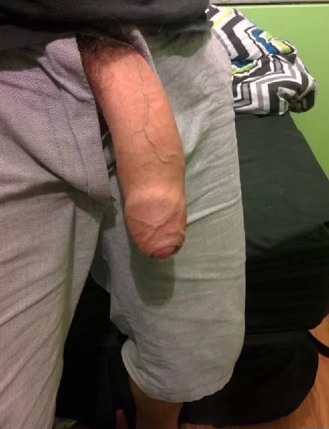 Needs sucking Needs sucking