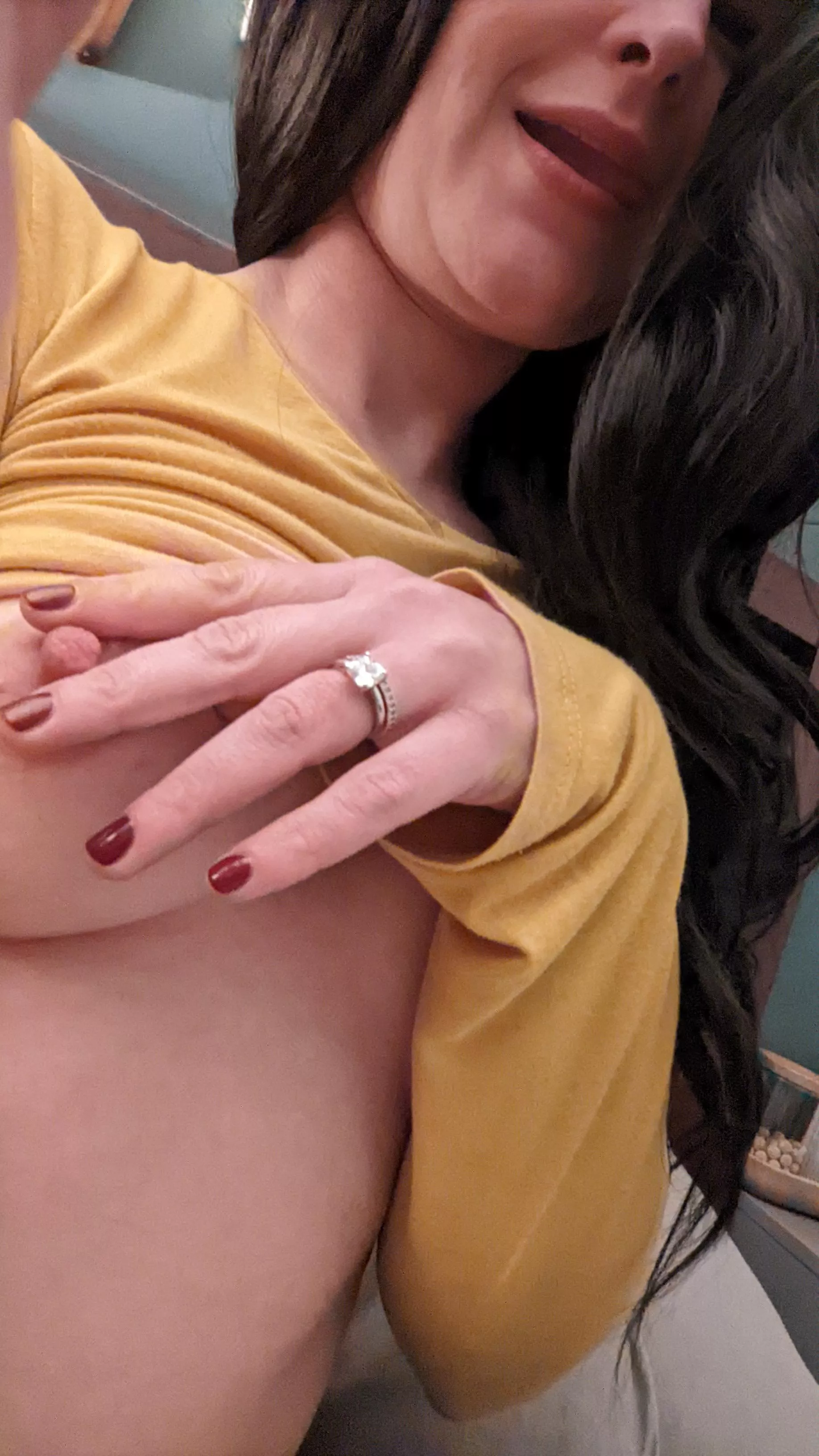 Nips need attention! Any takers?