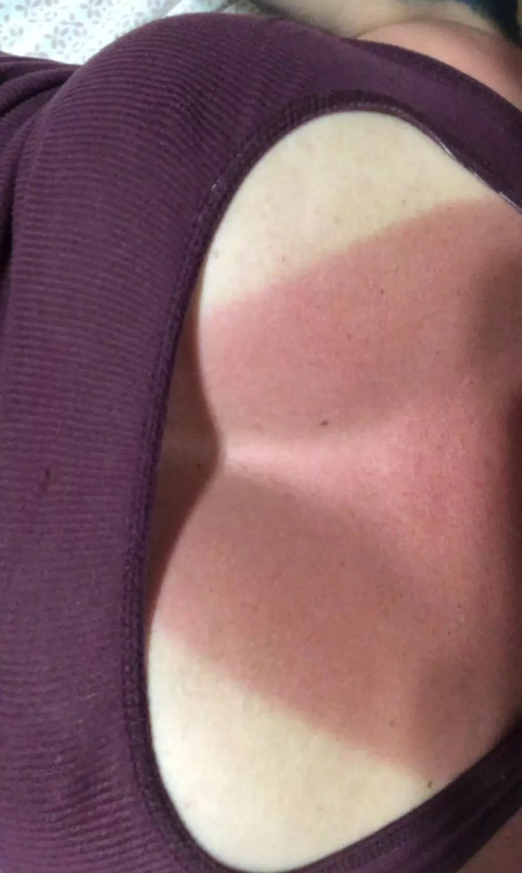 No bra burn lol No bra burn lol