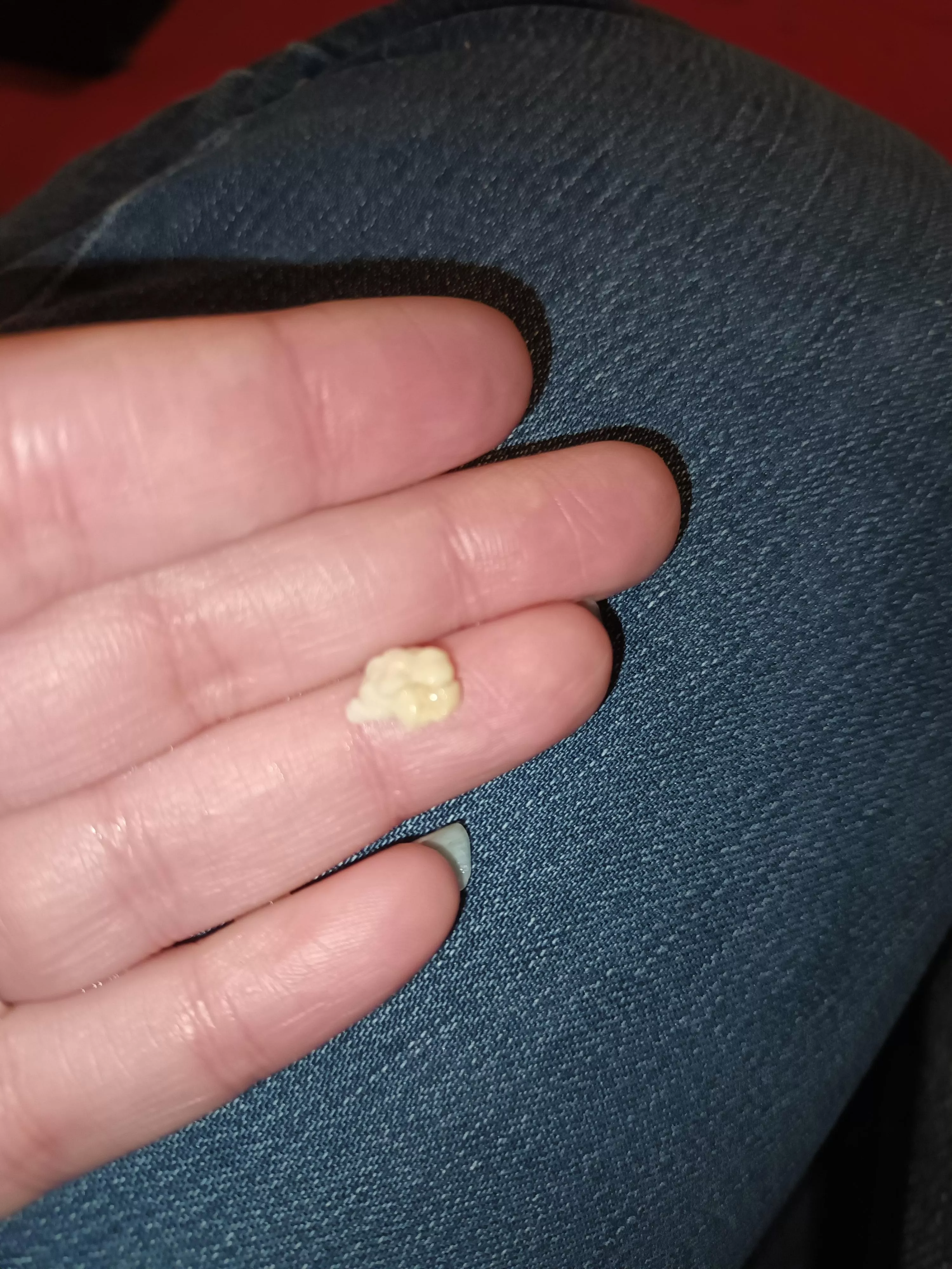 NSFW sorry no pop but just had this huge tonsil stone come out has anyone else had a big one took me by surprise.
