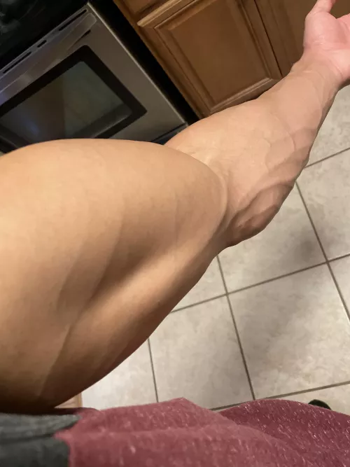 nurse still had a problem finding the vein 🤨 nurse still had a problem finding the vein 🤨