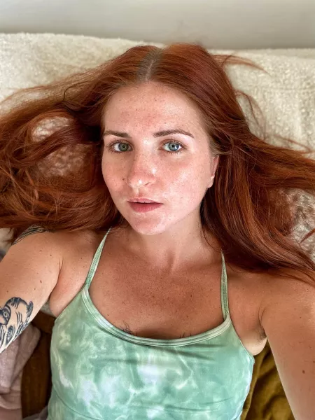 Obsessed with freckles hen ๐