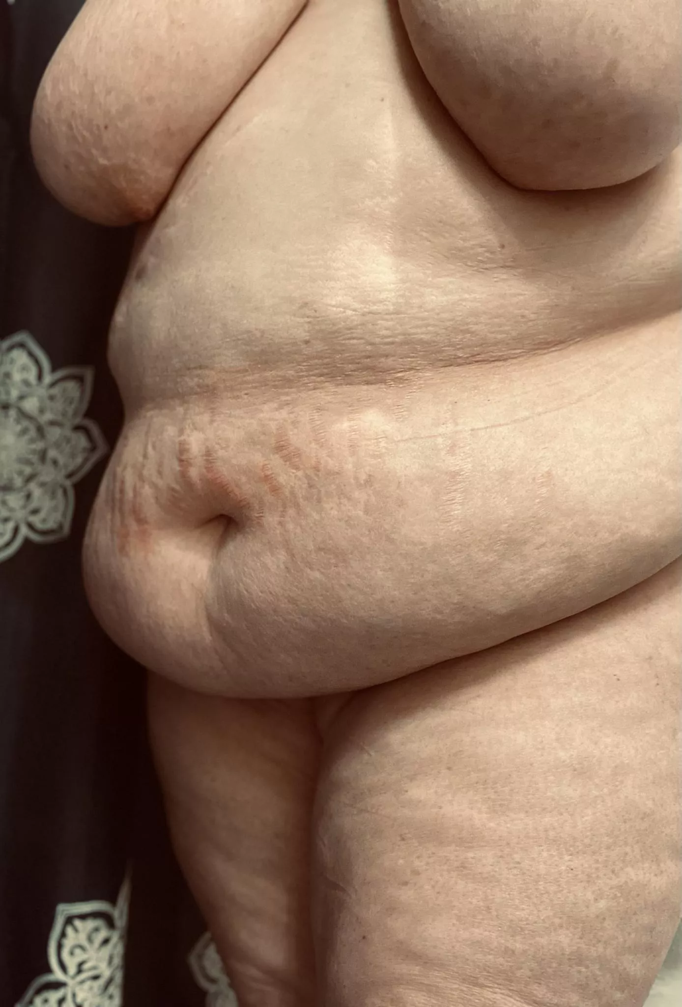 Obsessed with these stretch marks Obsessed with these stretch marks