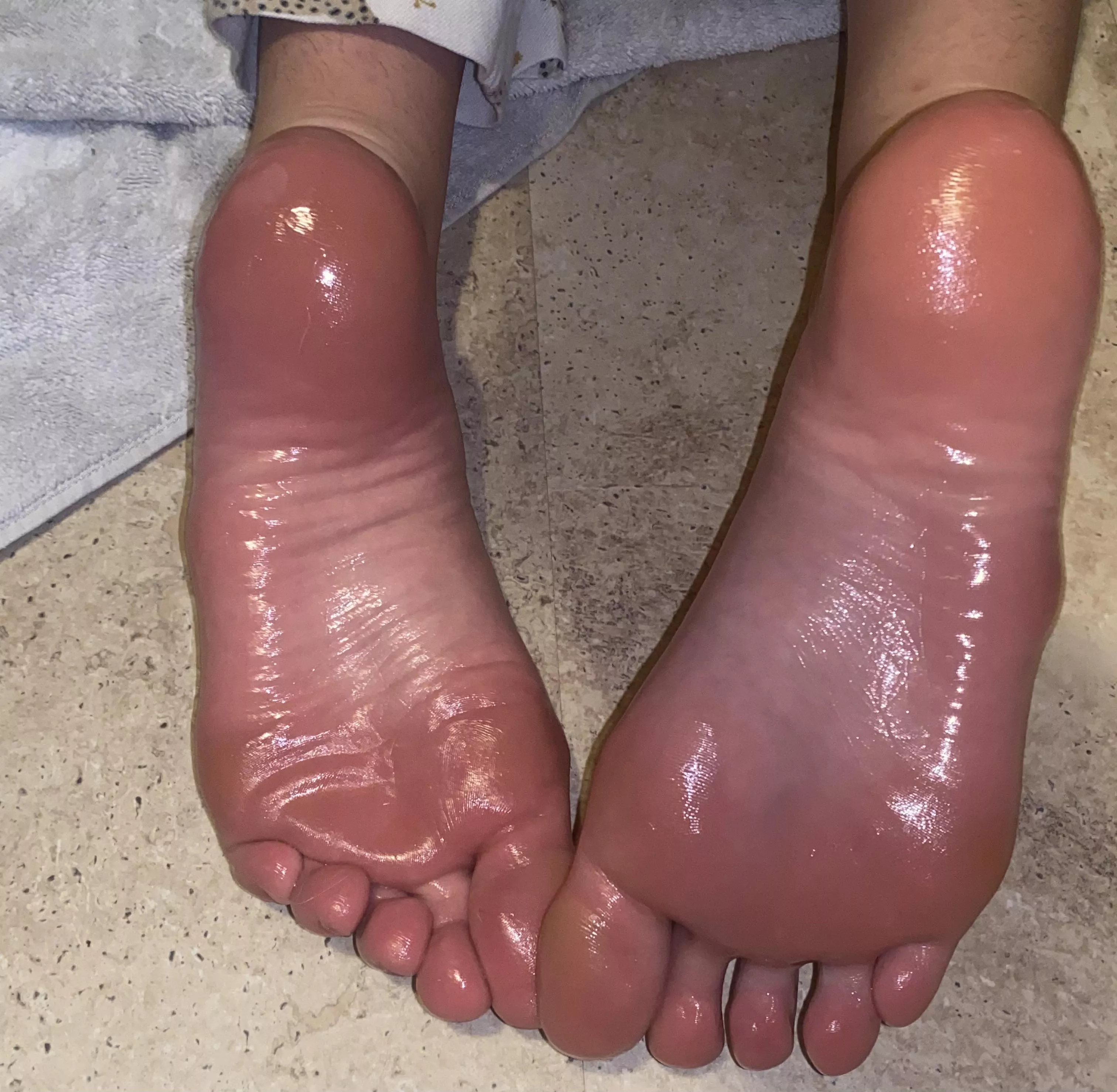 oily soles? oily soles?