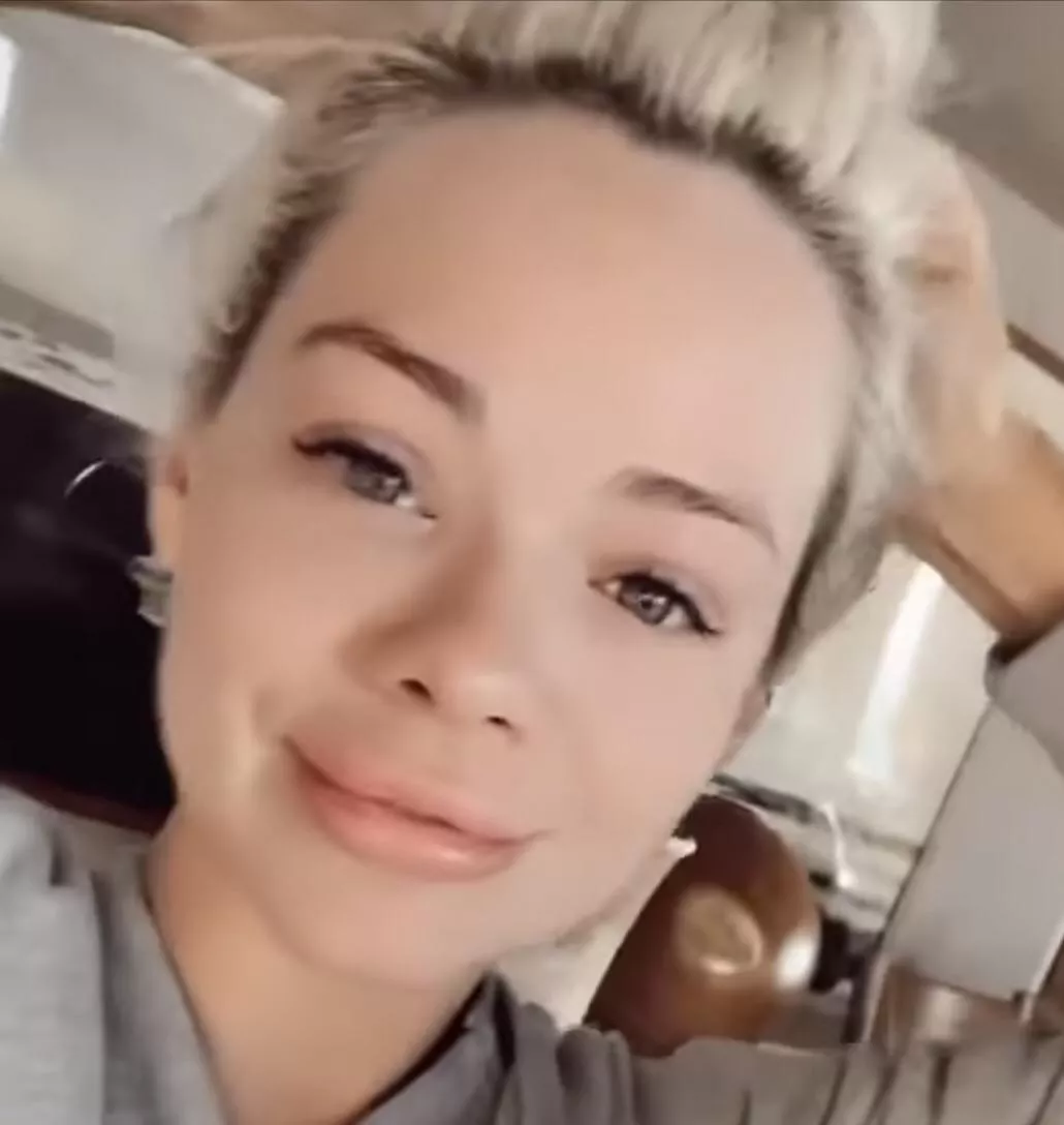 On TheGram: She’s says she’s beginning to like the look… may inject them…