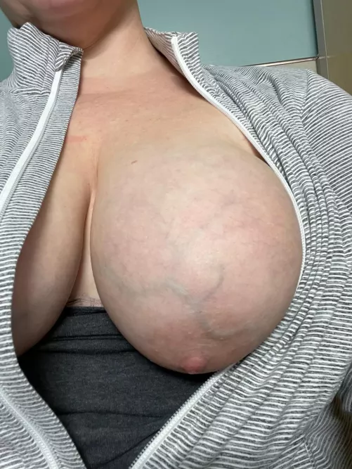 One fell out [image]