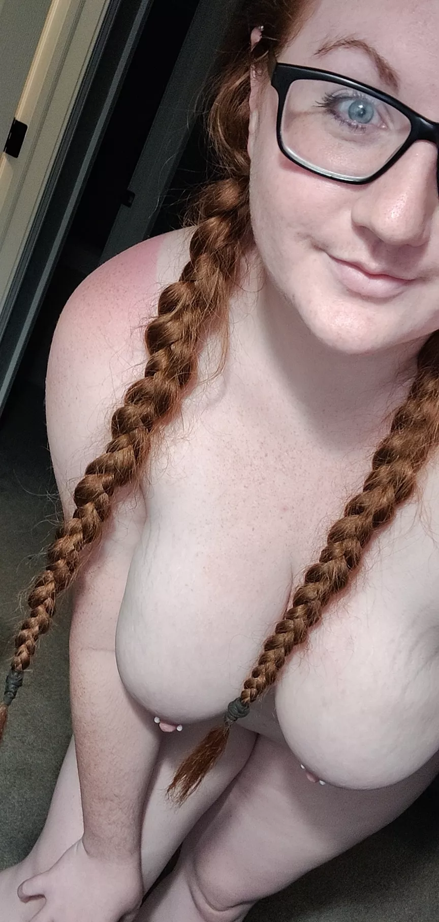 Only downside about being a ginger is the sun hates me π Only downside about being a ginger is the sun hates me π
