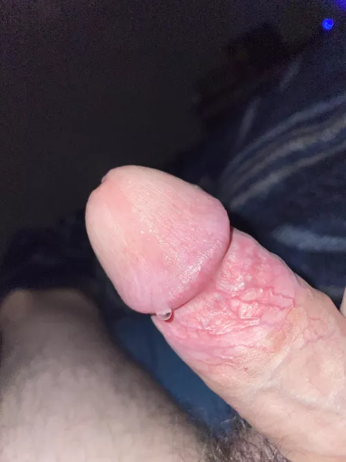 Oozing as always