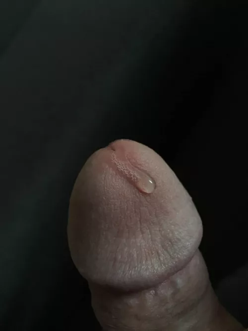 Oozing
