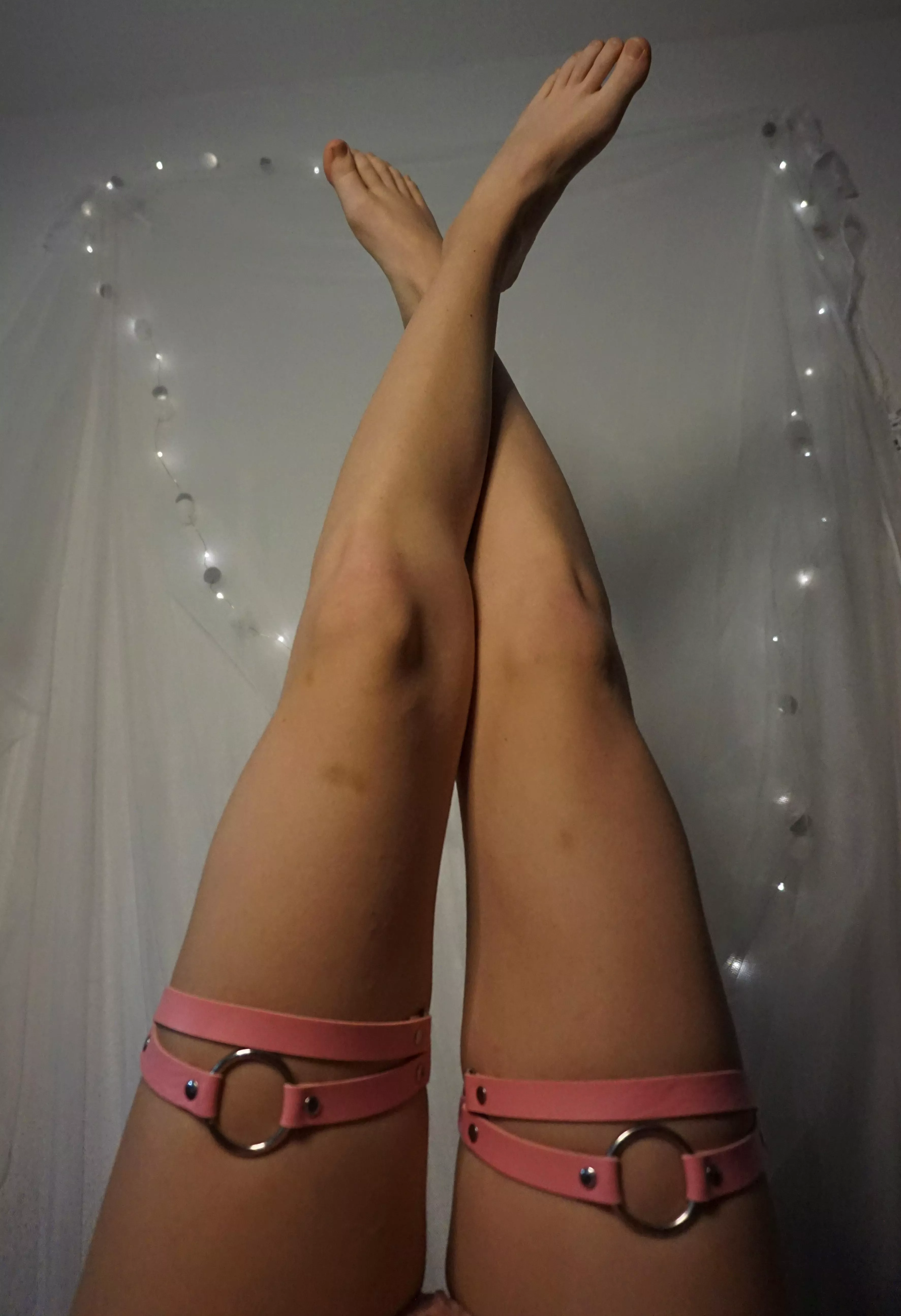 Pls ignore my bruises lol ???