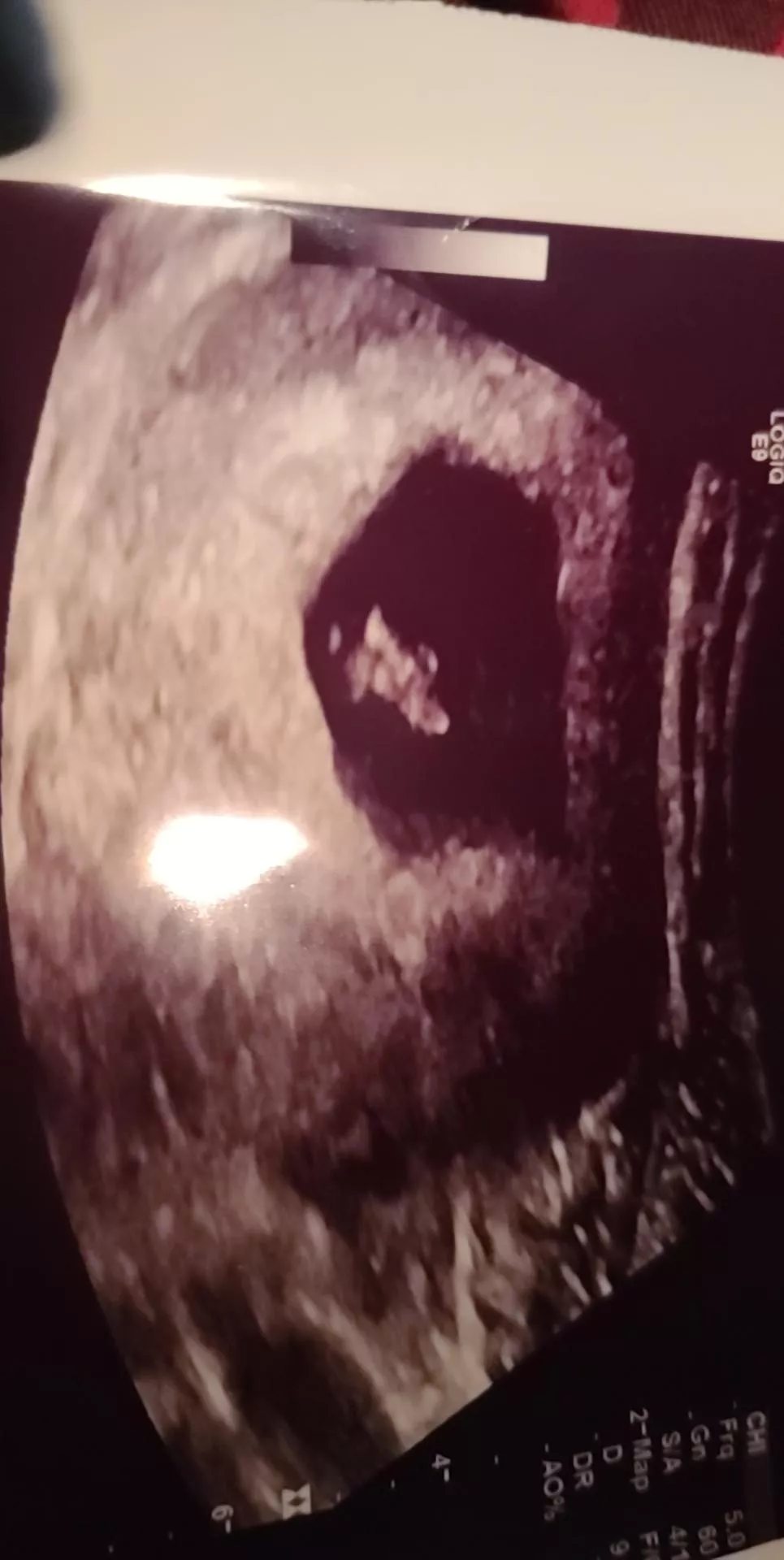 Positive Test at 11 days! Y'all get me my Whole Pregnancy this time! 7wks 4d