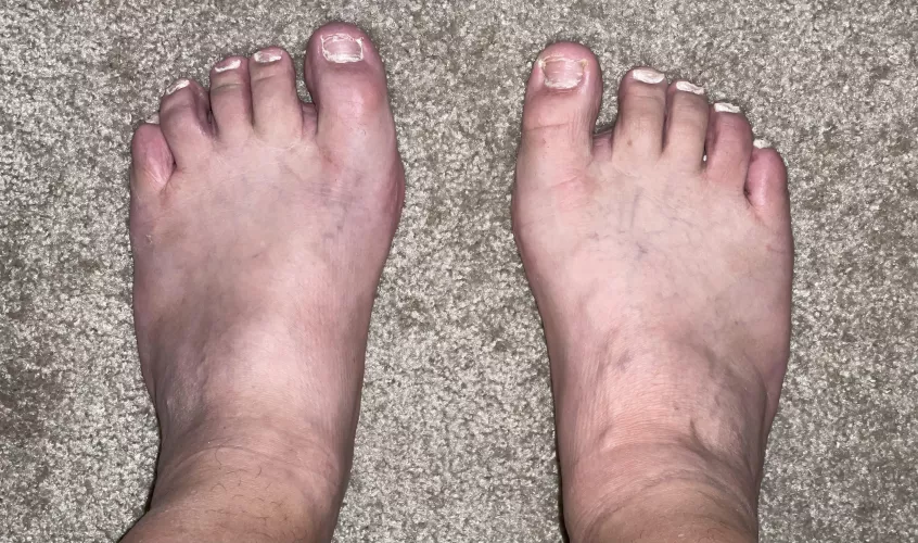 POV standing of my 13 6E wide feet. (Nails need to grow.)