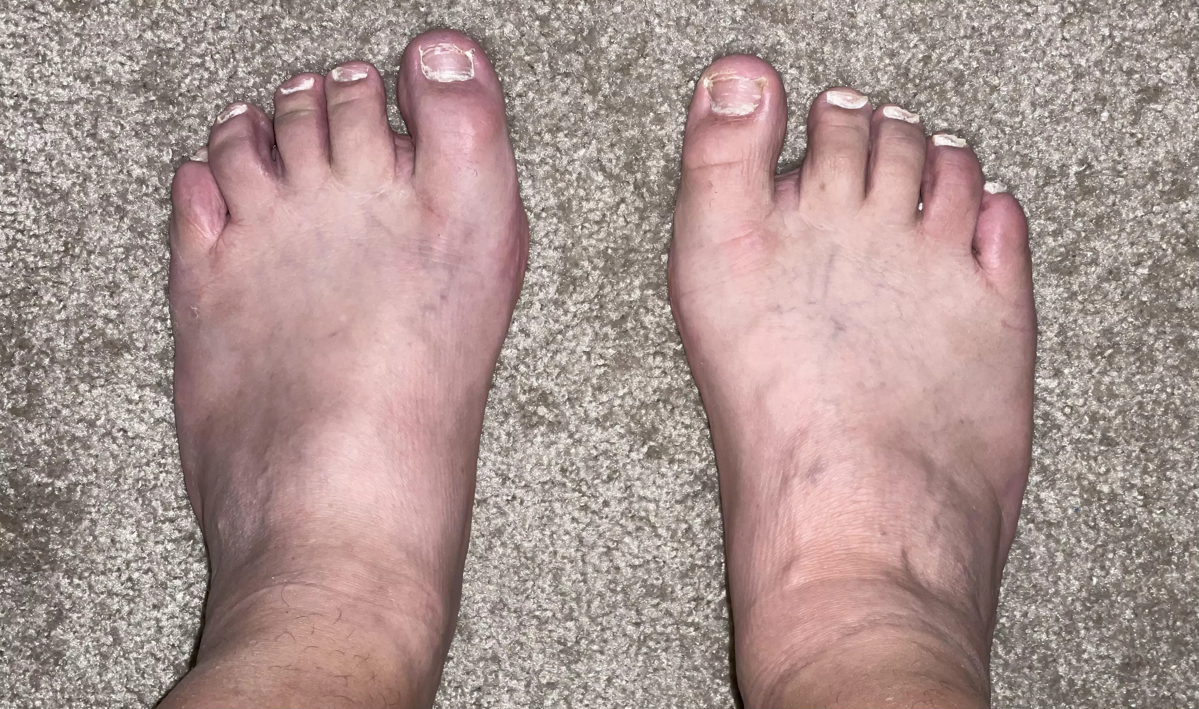 POV standing of my 13 6E wide feet. (Nails need to grow.)