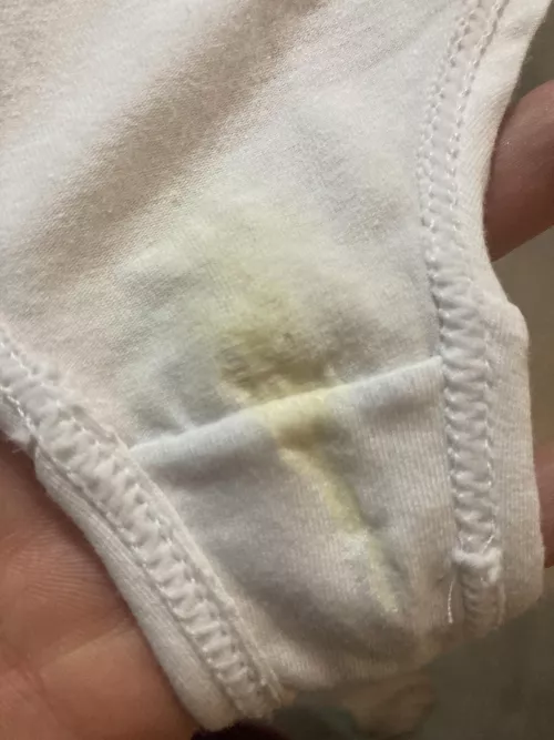 Pregnancy cream