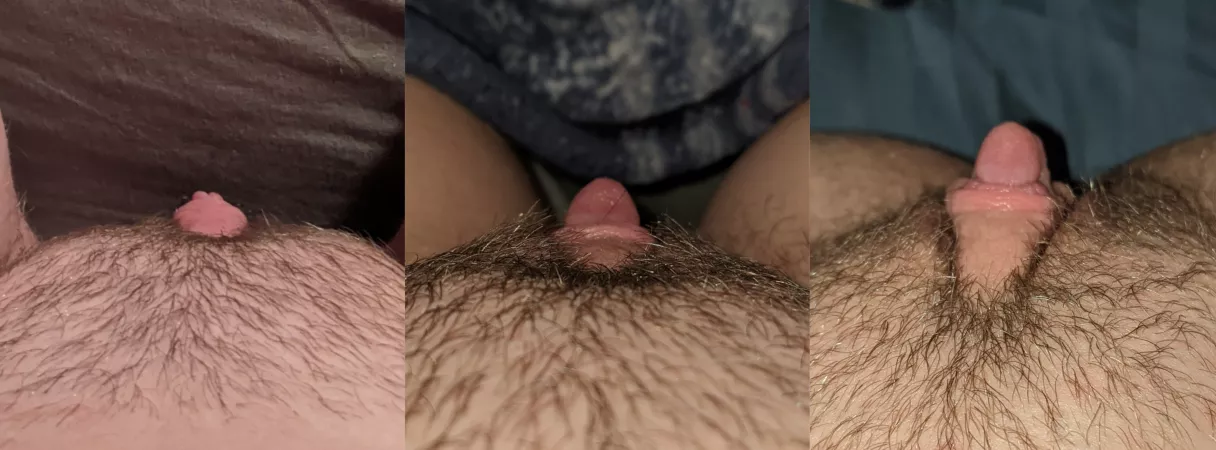 Progression of my clit growth 3 weeks on T, first time pumping, and last ni...