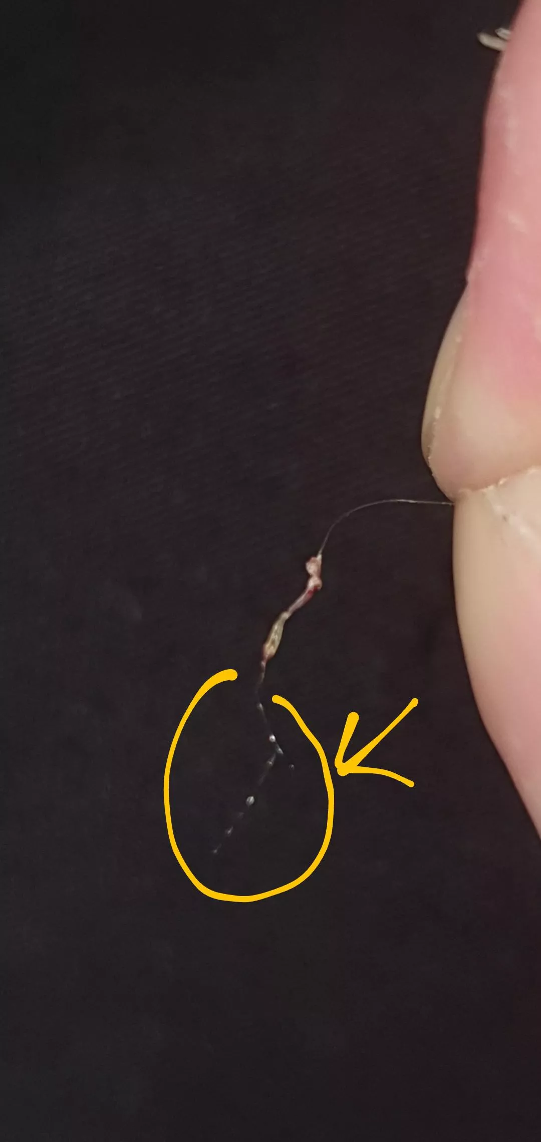 (Pulled hair) So, does anyone here know what these are?