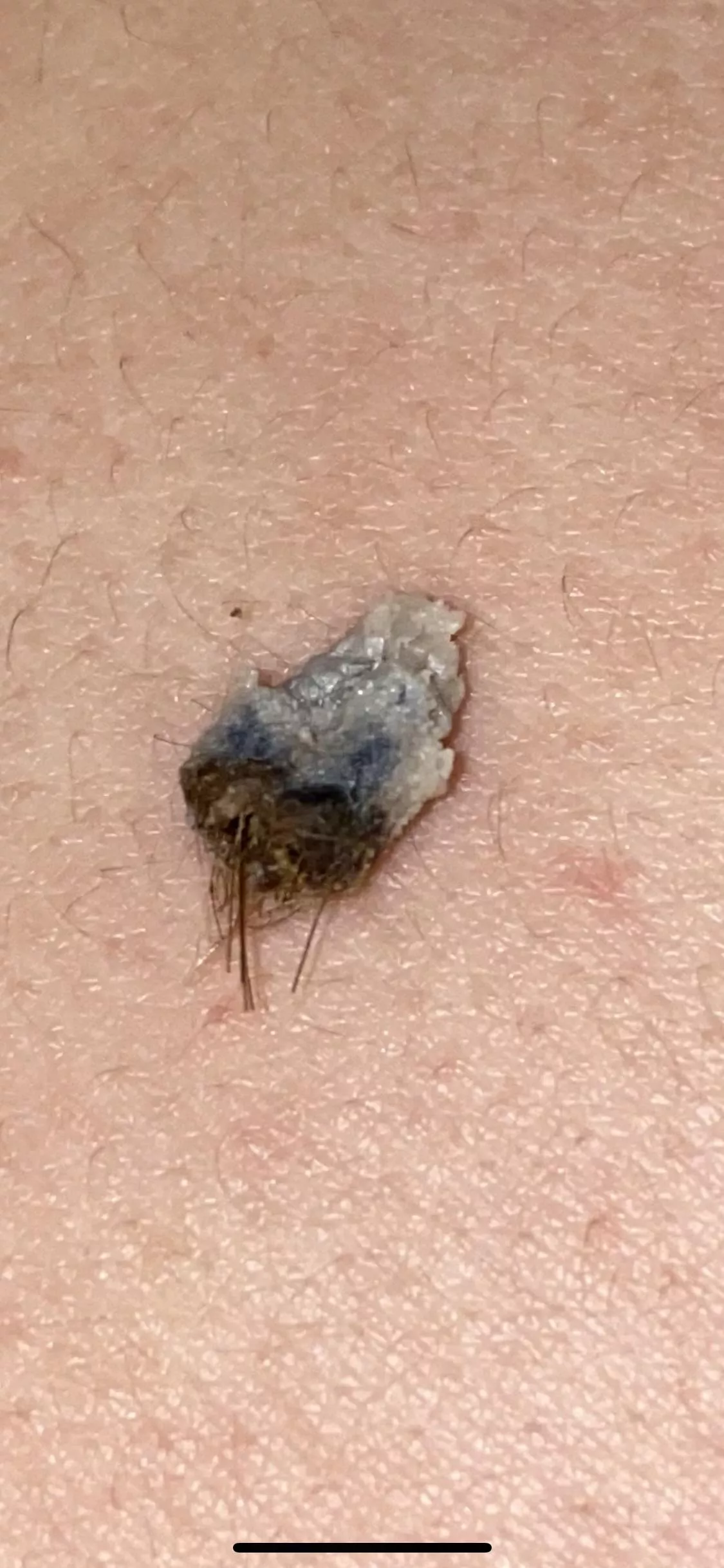 Pulled out of a belly button… thoughts?