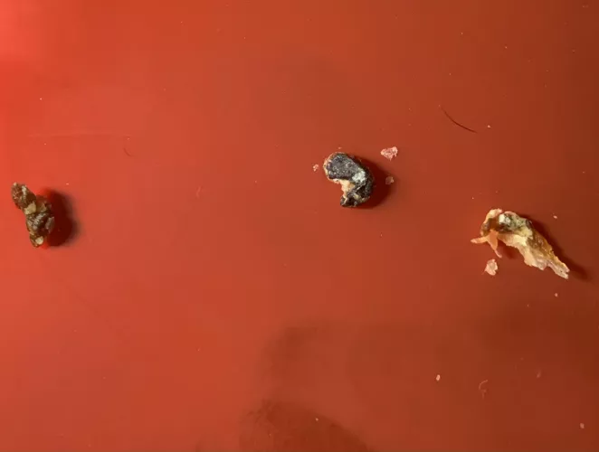 Pulled these out of my ears.