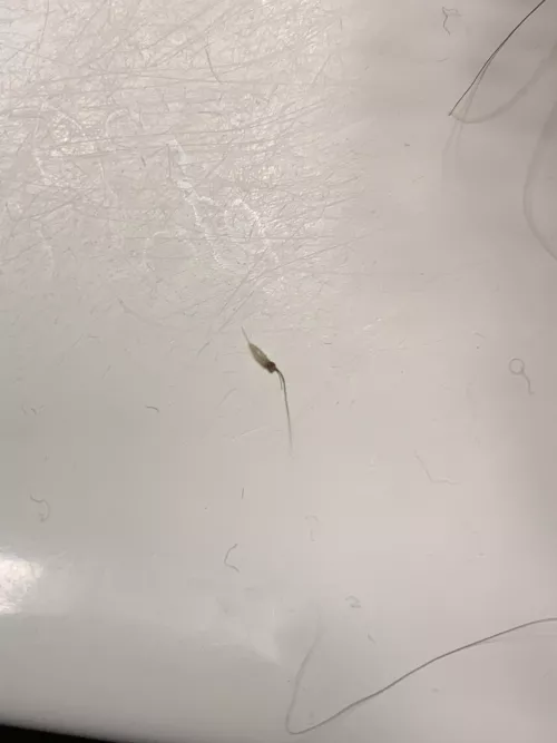 Pulled this little guy out from my pubic area