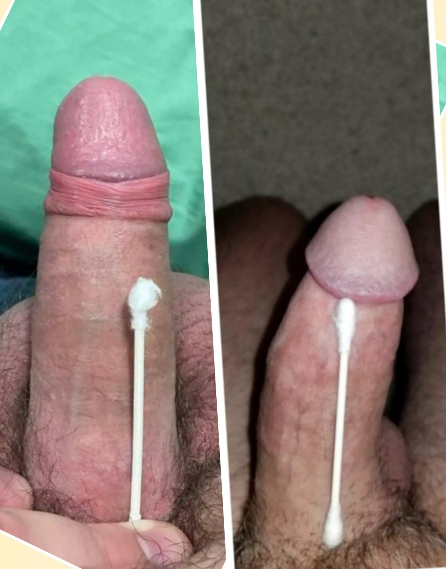 R/anon120202020 vs me(r) R/anon120202020 vs me(r)