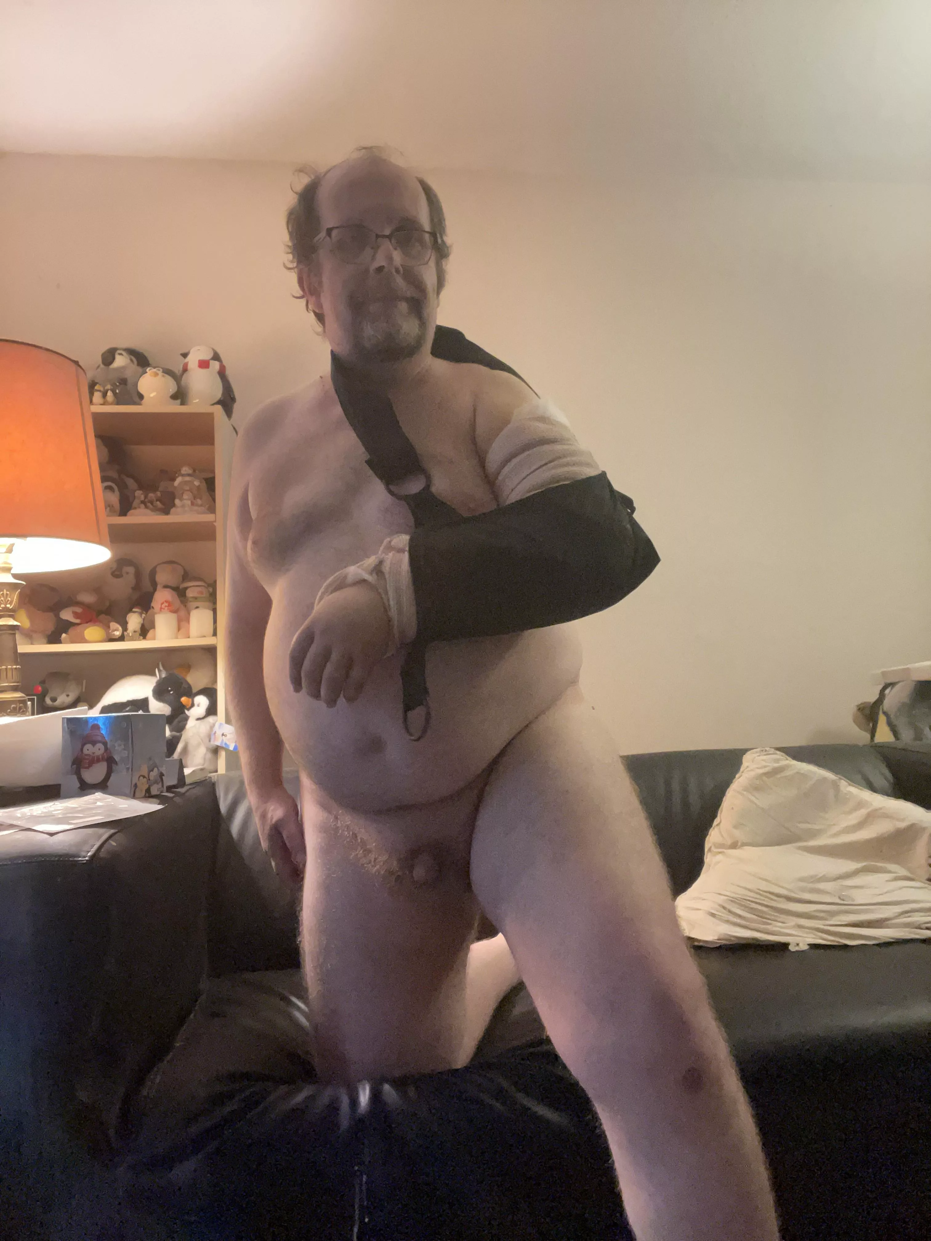 Recovery process in progress! (Arm broken in multiple places and dislocated elbow). Recovery process in progress! (Arm broken in multiple places and dislocated elbow).