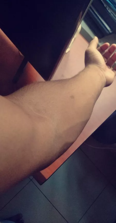 Relaxed forearm Relaxed forearm