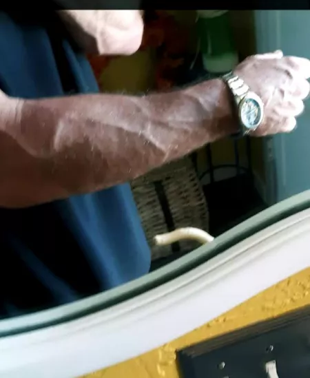 Right arm Right arm