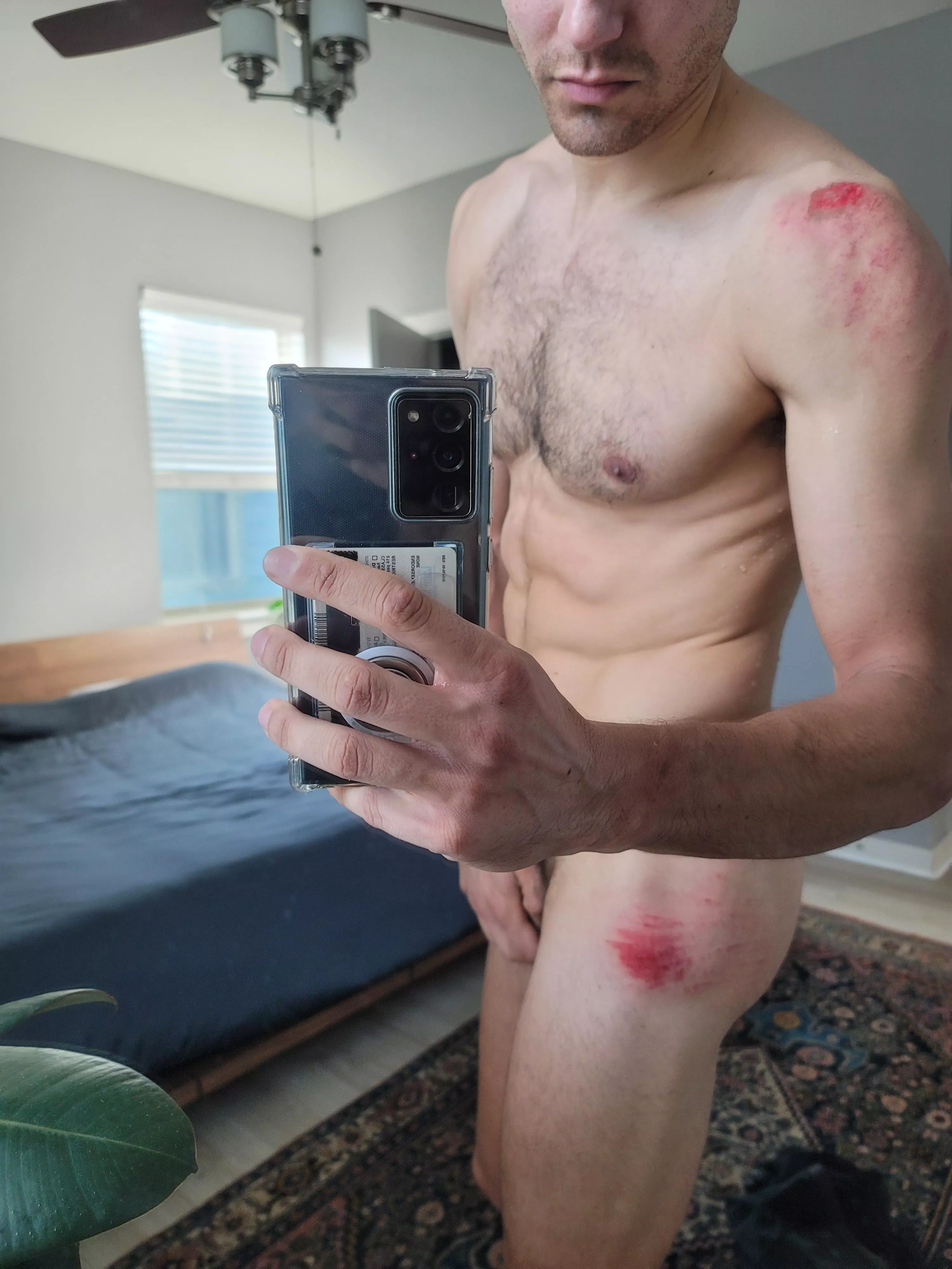 Ringing in the new year right with a bike crash 😅