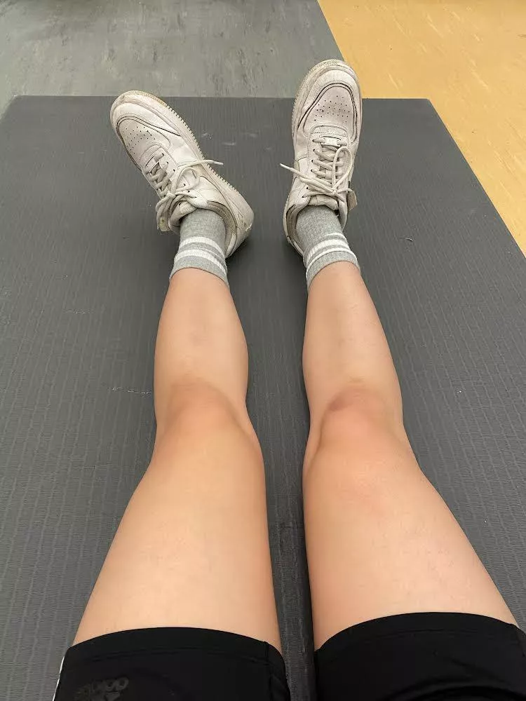 Scar is from that time I fell off the bike and ate doo doo Scar is from that time I fell off the bike and ate doo doo