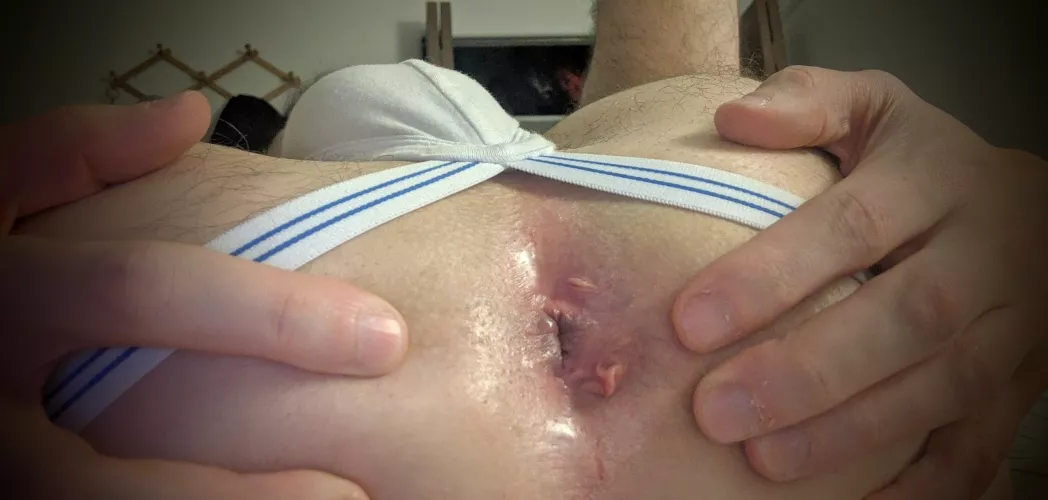 Self Conscious About Skin Tags. Okay or Gross?