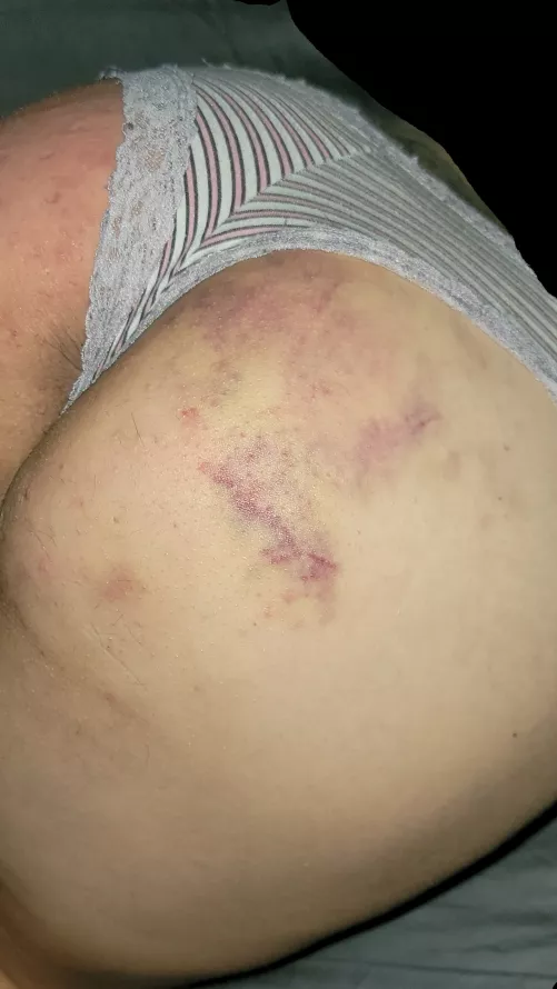 She Wears My Marks So Beautifully