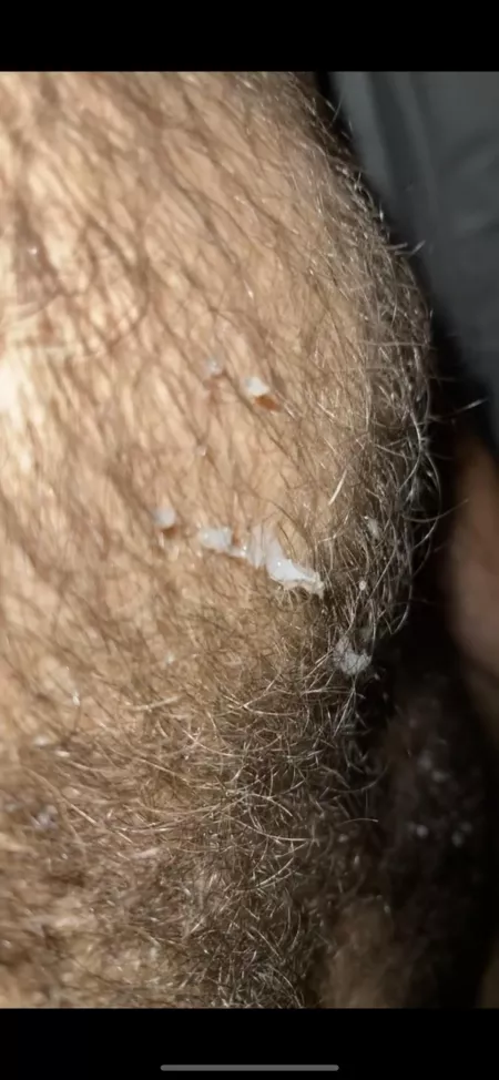 Shot up to my neck and covered my chest hair last night š¦ video on my OF š