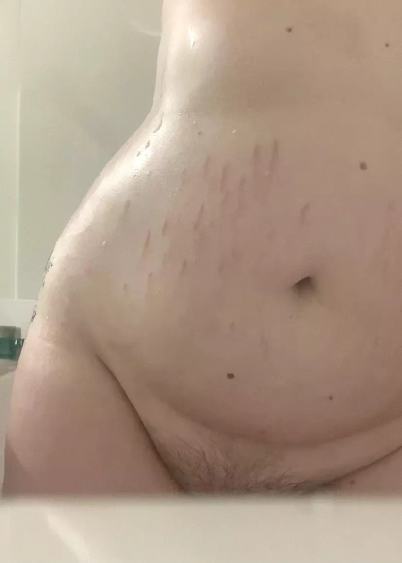 showing off my stretch marks (oc) 💘