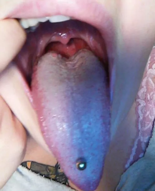 So Enticing!