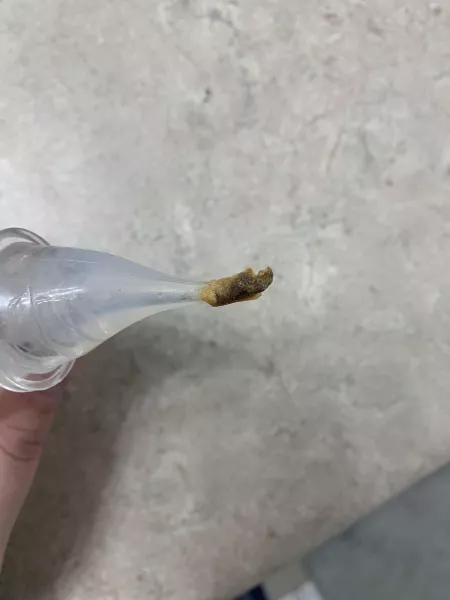 So I was irrigating my ears and this hooked on!