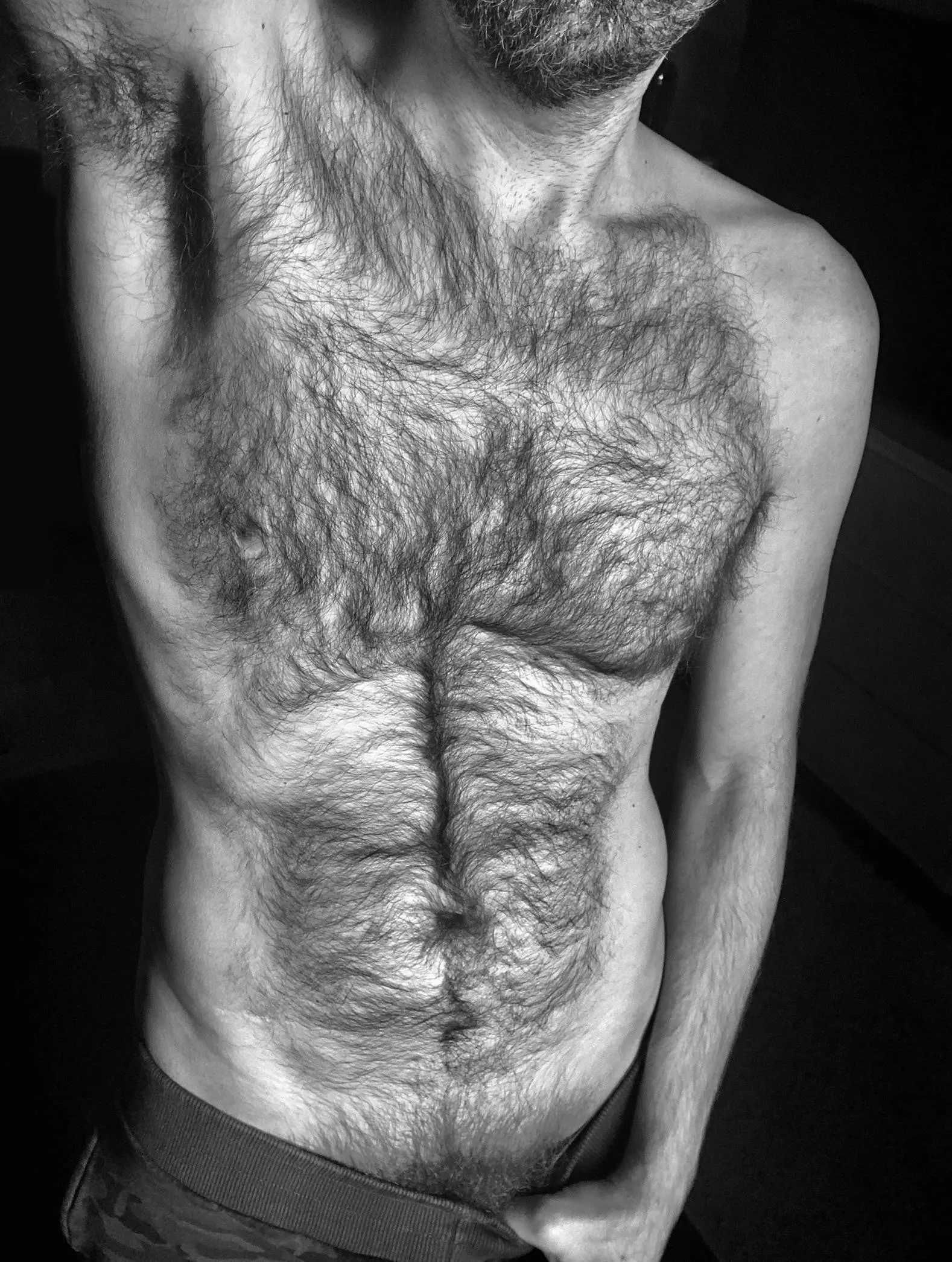 so. much. fucking. fur.