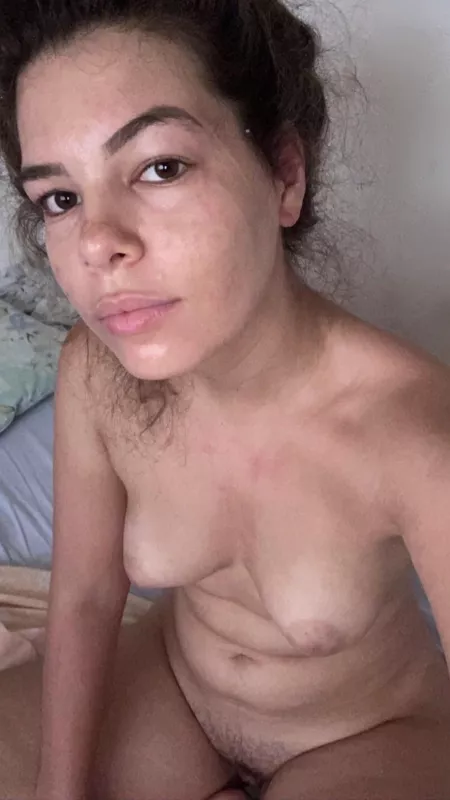 So swollen , I feel like I could feed everyone ๐