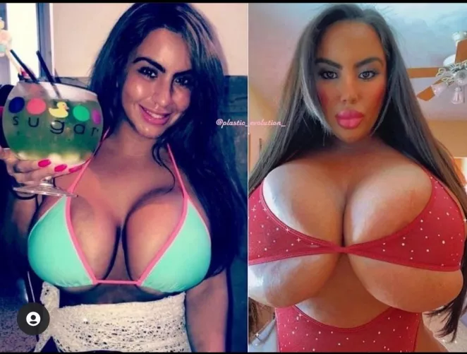 Some definite improvements