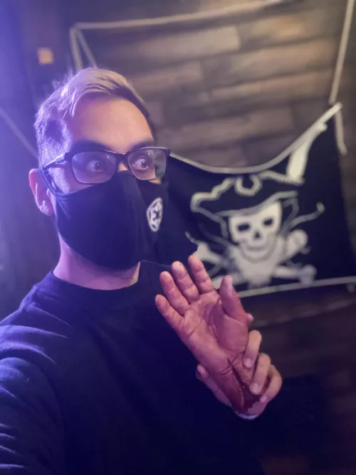 Some pun about, needing a hand or something, idk…