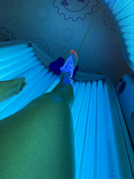 Someone care to remove these for me!? Someone care to remove these for me!?