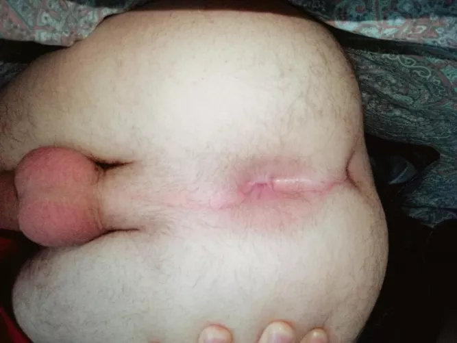 Spreading my 19 yr old virgin buttholeβ¨