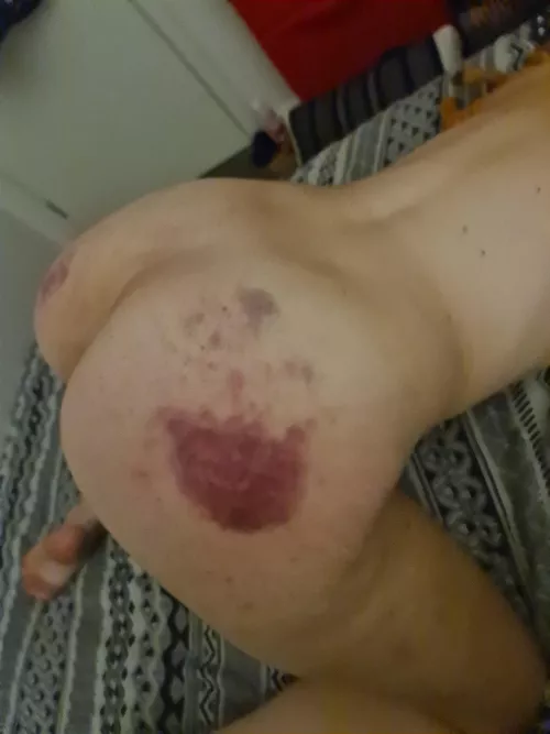 Submissive [F]reshly bruised.