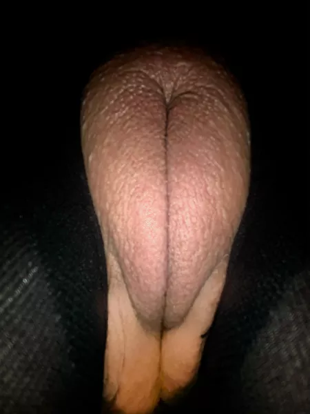 Such a pretty shaved pantyhose pussy puff Such a pretty shaved pantyhose pussy puff