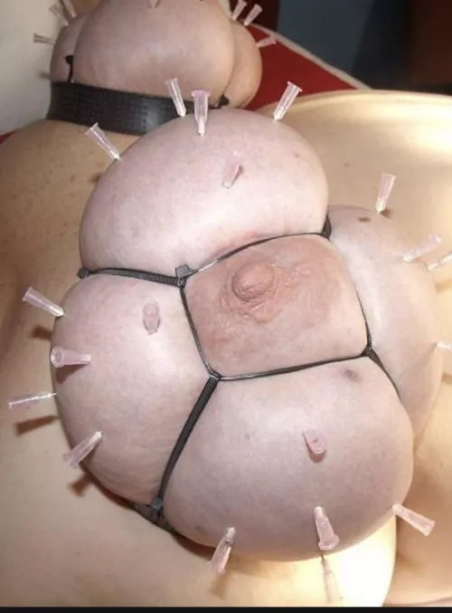 Such a special treatment