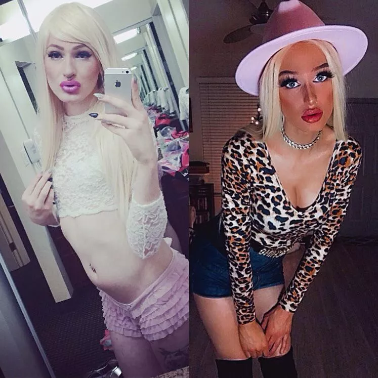 (T) Long time no see! As u can see the hormones and filler were good to me💞