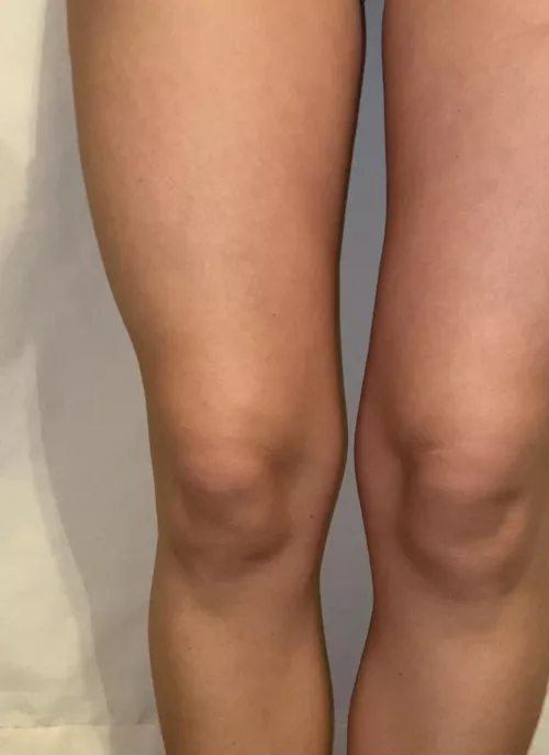 Tanned legs.. 🥰 Tanned legs.. 🥰