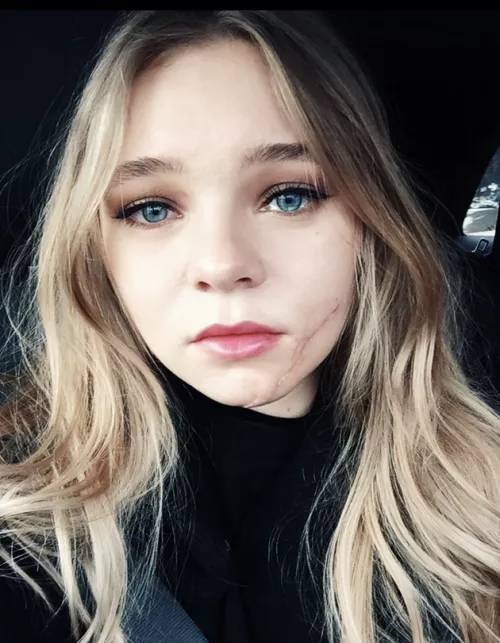 Taylor Hickson Taylor Hickson