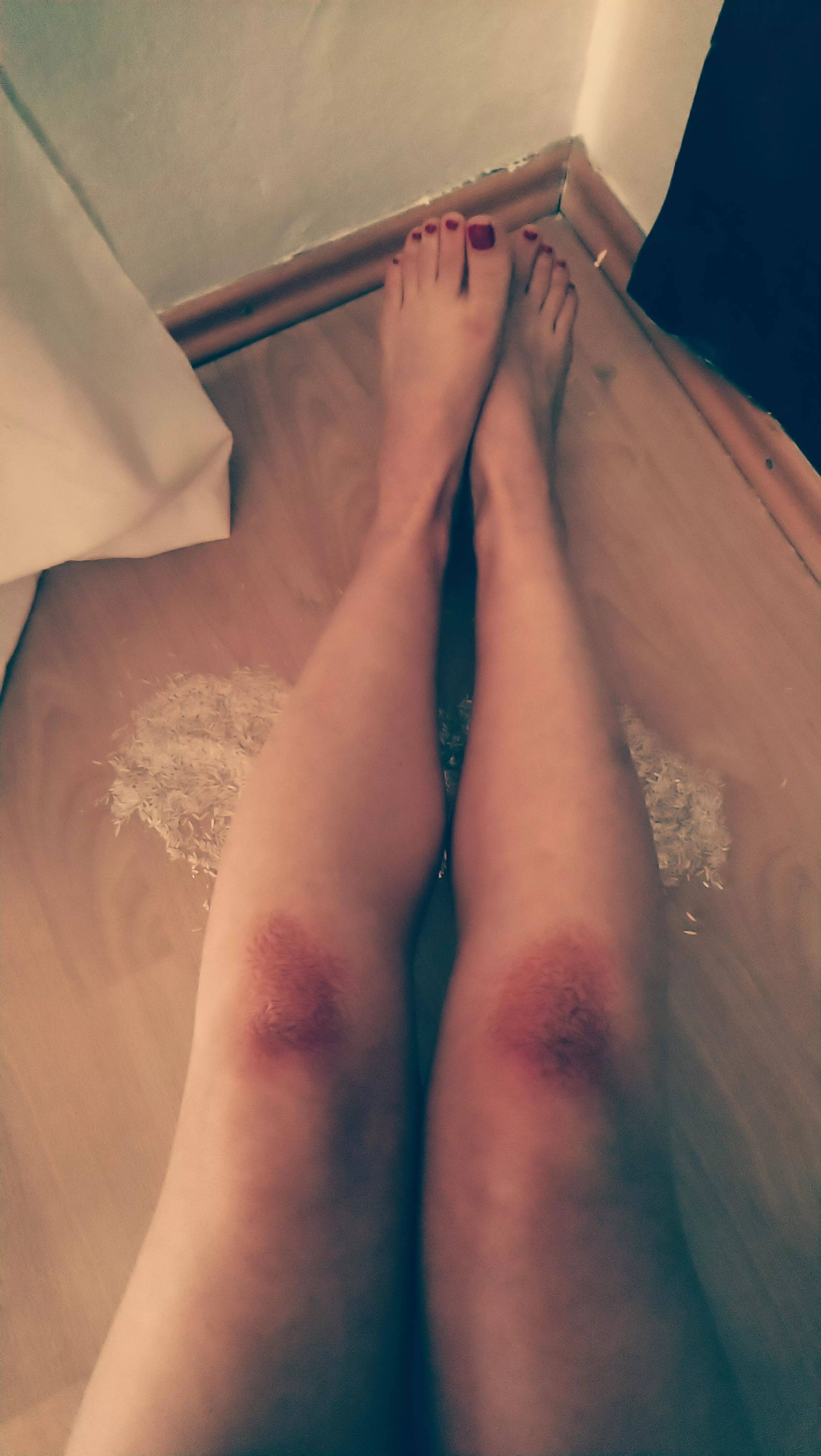 The cure to all bratiness😇 is kneeing in raw rice for 25 minutes with a gingerplug inside you. i challenge you to stay relaxed😈🙂