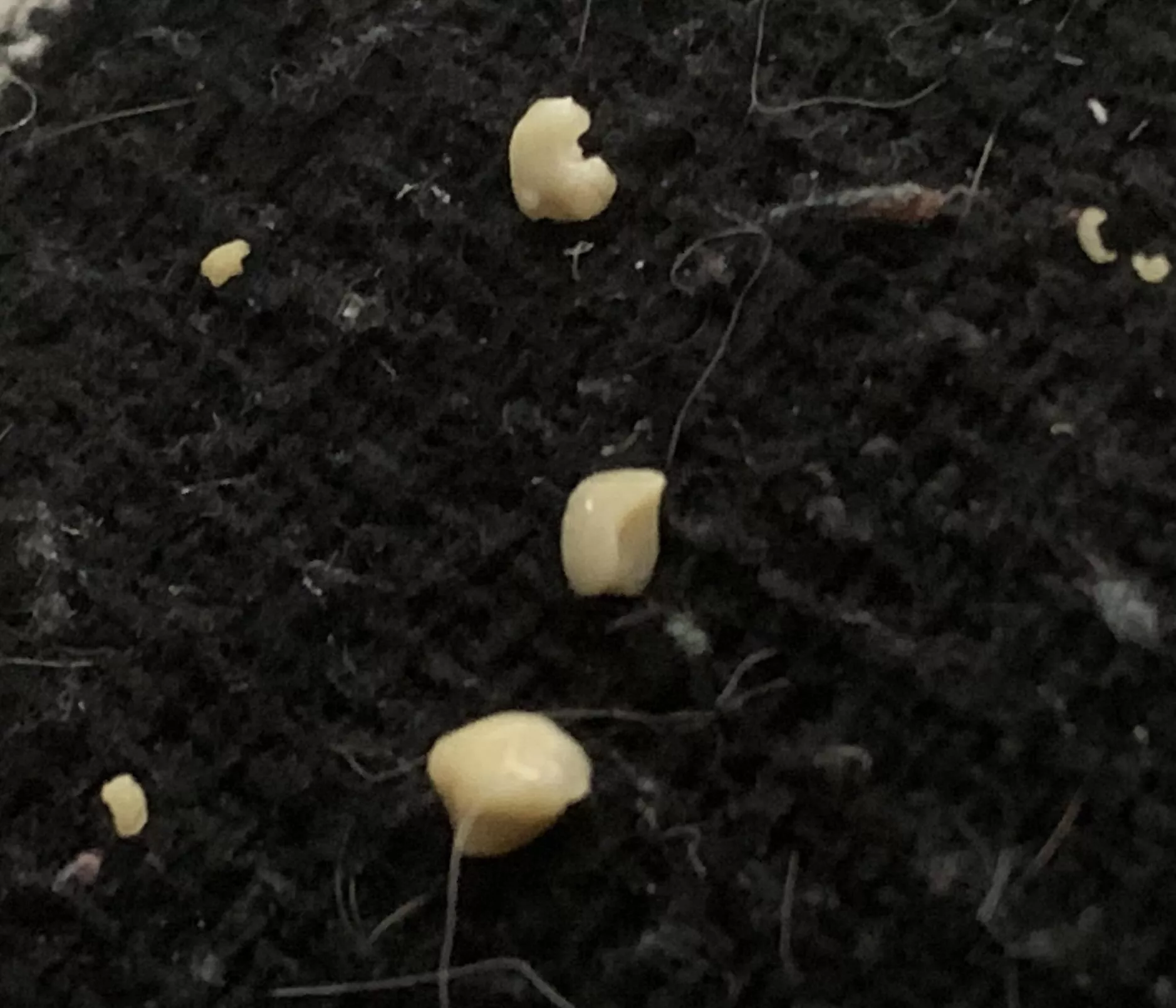 These tonsil stones decided that it was time to shine. The biggest one is the size of my fingernail!