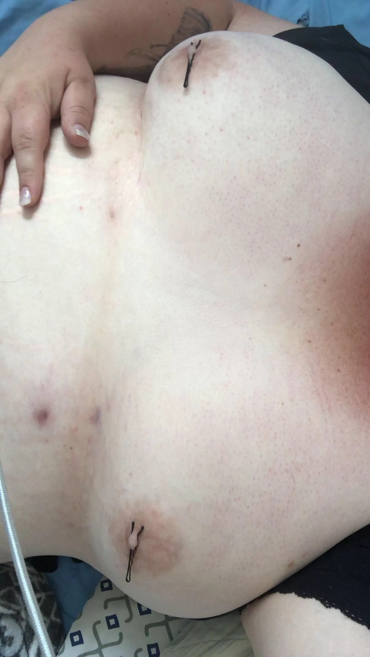 They just love to be pinched. They just love to be pinched.